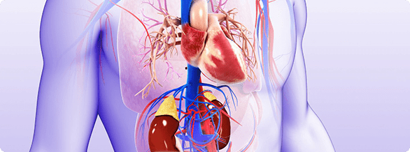Renal Denervation Therapy
