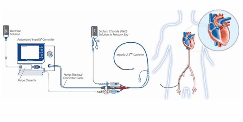 Impella Device Impella Device