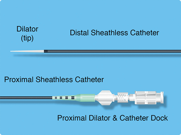 Sheathless Angioplasty
