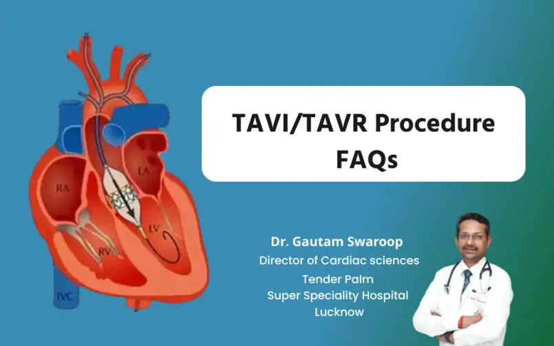 tavi tavr procedure faqs explained by dr gautam swaroop at tender palm hospital lucknow