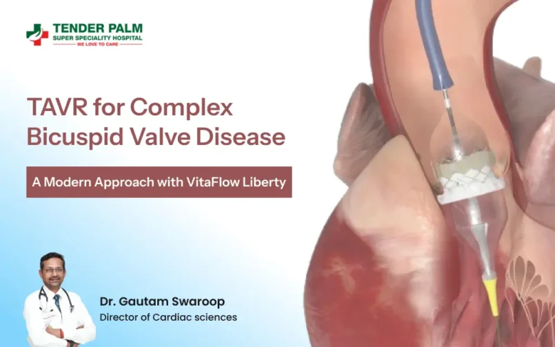 Illustration of a transcatheter aortic valve replacement (TAVR) procedure for bicuspid aortic valve disease.