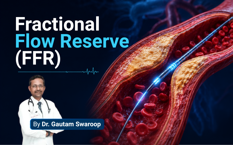 3D illustration of the FFR full form in medical, demonstrating a Fractional Flow Reserve test measuring blood pressure inside a blocked coronary artery.