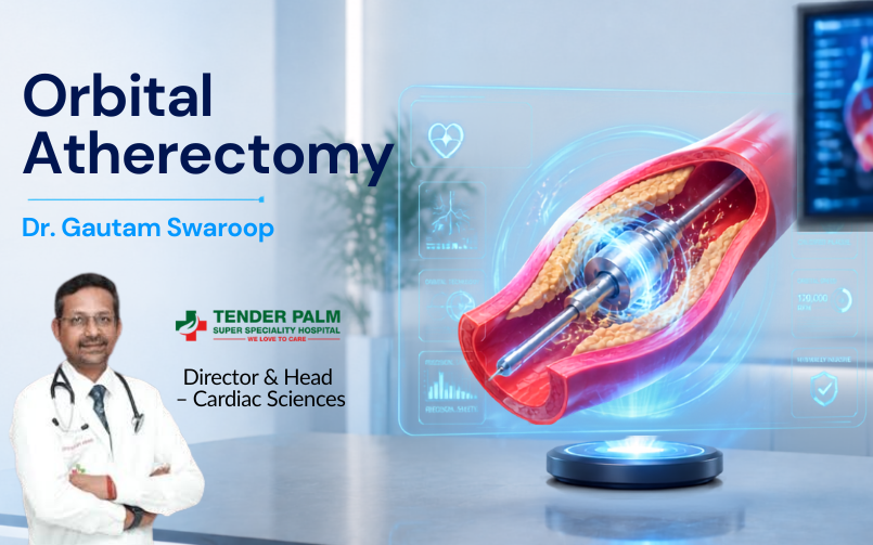 Advanced orbital atherectomy illustration showing a diamond-coated crown removing calcified plaque inside a coronary artery, demonstrating a modern interventional cardiology procedure by Dr. Gautam Swaroop.