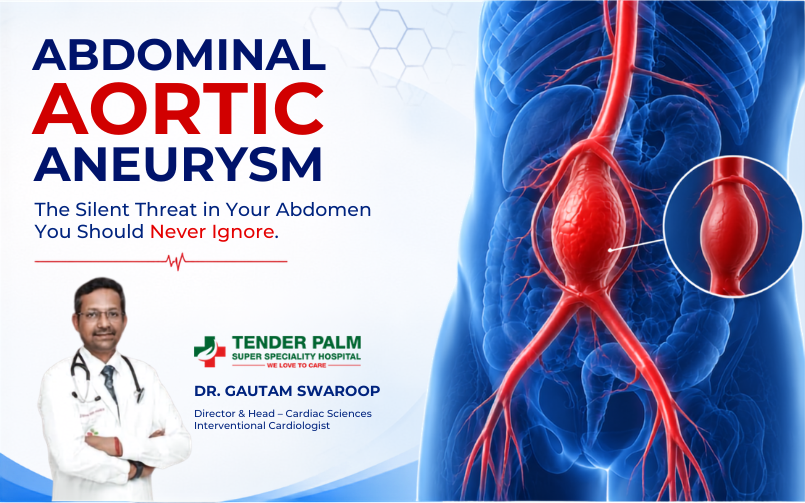 An informational medical poster titled "ABDOMINAL AORTIC ANEURYSM" with the subtitle "The Silent Threat in Your Abdomen You Should Never Ignore." On the bottom left is a photo of Dr. Gautam Swaroop, Director & Head of Cardiac Sciences and Interventional Cardiologist, next to the Tender Palm Super Speciality Hospital logo. The right side features a 3D, blue-toned anatomical illustration of a human torso highlighting the abdominal aorta in bright red. The aorta has a large, swollen bulge indicating an aneurysm, which is further detailed in a magnified circular inset.