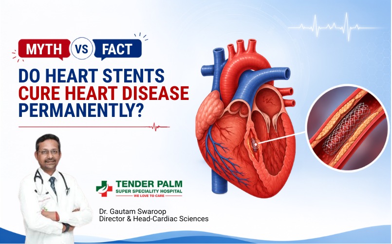 Myth vs Fact infographic asking 'Do heart stents cure heart disease permanently?' featuring a 3D illustration of a human heart with a stent, alongside Dr. Gautam Swaroop from Tender Palm Super Speciality Hospital.
