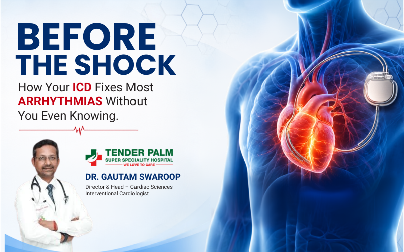 Dr. Gautam Swaroop cardiology blog banner titled “Before the Shock,” showing an ICD device connected to the heart and highlighting how ICDs treat arrhythmias before a shock is needed.
